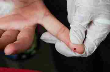  SUS passa a oferecer teste rápido de dengue 